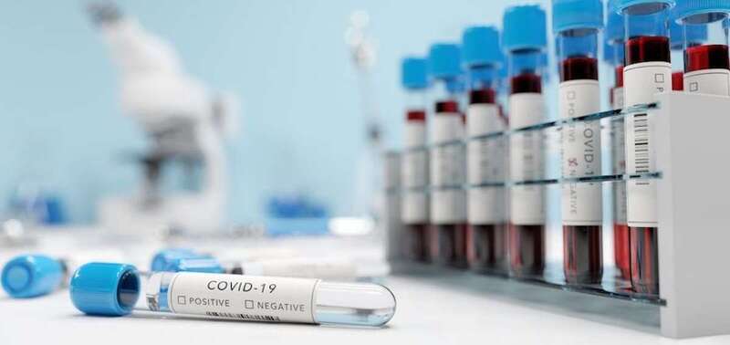 Test de coronavirus/TA.